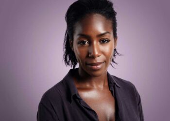 Advantages of Oily Skin