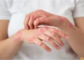 How to Identify Scabies: What Does Scabies Look Like?